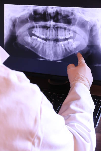 Best Emergency Dental Care for Broken or Chipped Teeth in Martinsburg, PA