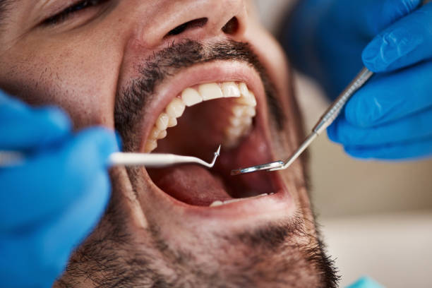Best Emergency Gum Treatment in Martinsburg, PA